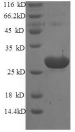 Greater than 90% as determined by SDS-PAGE.