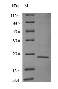 Greater than 90% as determined by SDS-PAGE.Recombinant Human T Cell Receptor Beta Constant 1 (TRBC1) Protein (His)