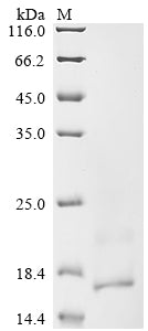 Greater than 90% as determined by SDS-PAGE.Recombinant Human T Cell Receptor Beta Constant 2 (TRBC2) Protein (His)
