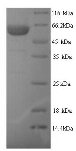 Greater than 90% as determined by SDS-PAGE.Recombinant Human E3 Ubiquitin-Protein Ligase Trim21 (TRIM21) Protein (His)