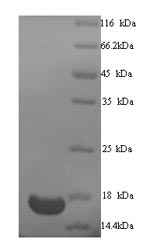 Greater than 90% as determined by SDS-PAGE.Recombinant Human Transcription Intermediary Factor 1-Alpha (TRIM24) Protein (His)