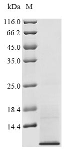 Greater than 90% as determined by SDS-PAGE.Recombinant Human Tetraspanin-2 (TSPAN2) Protein (His)