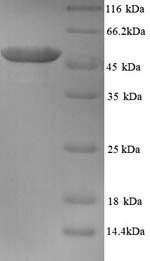 Greater than 90% as determined by SDS-PAGE.Recombinant Human Tubulin Beta-2A Chain (TUBB2A) Protein (His)