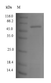 Greater than 90% as determined by SDS-PAGE.Recombinant Human Tyrosinase (TYR) Protein (His)