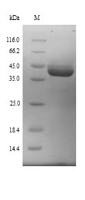 Greater than 90% as determined by SDS-PAGE.Recombinant Mouse Ubiquitin-Protein Ligase E3A (UBE3A) Protein (His)