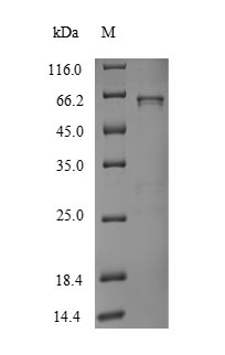 Greater than 90% as determined by SDS-PAGE.Recombinant Human Udp-Glucuronosyltransferase 1-1 (UGT1A1) Protein (His)