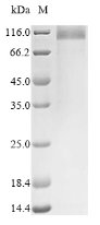 Greater than 90% as determined by SDS-PAGE.Recombinant Mouse Uromodulin (UMOD) Protein (His)
