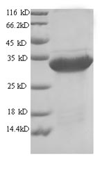Greater than 90% as determined by SDS-PAGE.Recombinant Arthrobacter Globiformis Uricase (UOX) Protein (His)