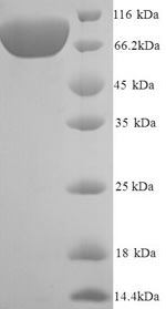 Greater than 90% as determined by SDS-PAGE.Recombinant Human Vascular Cell Adhesion Protein 1 (VCAM1) Protein (His)