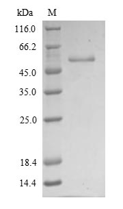 Greater than 90% as determined by SDS-PAGE.Recombinant Human Vimentin (VIM) Protein (His)