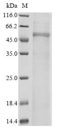 Greater than 85% as determined by SDS-PAGE.Recombinant Human Wiskott-Aldrich Syndrome Protein (WAS) Protein (His)