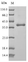 Greater than 90% as determined by SDS-PAGE.Recombinant Human Protein Wnt-5A (WNT5A) Protein (His)