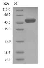 Greater than 90% as determined by SDS-PAGE.Recombinant Human Wilms Tumor Protein (WT1) Protein (His)