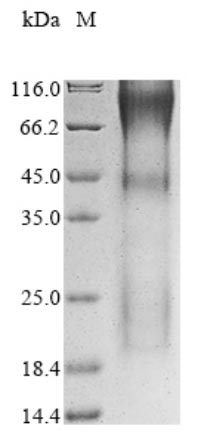Greater than 90% as determined by SDS-PAGE.Recombinant Human Transcriptional Coactivator Yap1 (YAP1) Protein (His)