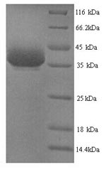 Greater than 90% as determined by SDS-PAGE.Recombinant Mouse Nuclease-Sensitive Element-Binding Protein 1 (YBX1) Protein (His)