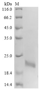 Greater than 90% as determined by SDS-PAGE.Recombinant Human Calcitonin Gene-Related Peptide 1 (CALCA) Protein (His-sumostar)