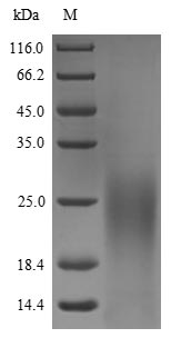 Greater than 90% as determined by SDS-PAGE.