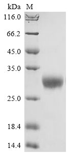 Greater than 90% as determined by SDS-PAGE.