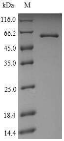 Greater than 90% as determined by SDS-PAGE.Recombinant Helicobacter Pylori Urease Subunit Beta (UREB) Protein (His)