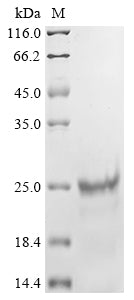 Greater than 85% as determined by SDS-PAGE.Recombinant Mycoplasma Pneumoniae P30 Adhesin (P30) Protein (His)
