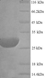 Greater than 90% as determined by SDS-PAGE.Recombinant Rat Type Ii Iodothyronine Deiodinase (DIO2) Protein (His)