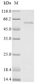 Greater than 90% as determined by SDS-PAGE.Recombinant Human Immunodeficiency Virus Type 1 Group M Subtype B Virion Infectivity Factor (VIF) Protein (His-sumostar)