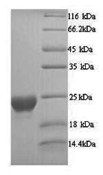 Greater than 90% as determined by SDS-PAGE.Recombinant Alternaria Alternata Major Allergen Alt A 1 (ALTA1) Protein (His)