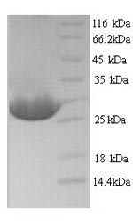 Greater than 90% as determined by SDS-PAGE.Recombinant Silene Chalcedonica Ribosome-Inactivating Protein Lychnin Protein (His)