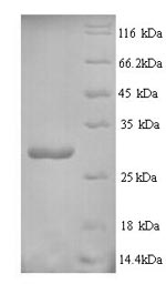 Greater than 90% as determined by SDS-PAGE.Recombinant Drimia Maritima Ribosome-Inactivating Protein Charybdin Protein (His)