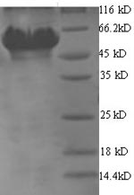 Greater than 90% as determined by SDS-PAGE.Recombinant Helicobacter Pylori Glutamate--Trna Ligase 1 (GLTX1) Protein (His)