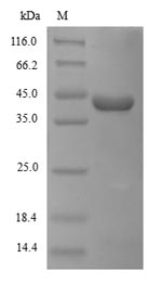 Greater than 90% as determined by SDS-PAGE.Recombinant Zaire Ebolavirus Pre-Small/Secreted Glycoprotein (GP) Protein (His)