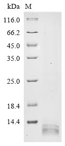 Greater than 90% as determined by SDS-PAGE.Recombinant Porphyromonas Gingivalis Gingipain R2 (RGPB) Protein (His)