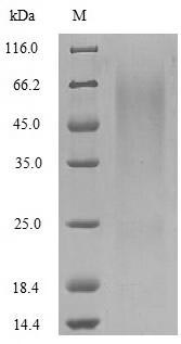 Greater than 90% as determined by SDS-PAGE.Recombinant Rotavirus A Outer Capsid Glycoprotein Vp7 Protein (His)