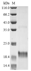 Greater than 90% as determined by SDS-PAGE.Recombinant Daboia Palaestinae Disintegrin Viperistatin Protein (His-Myc)