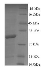 Greater than 90% as determined by SDS-PAGE.Recombinant Mycobacterium Tuberculosis Diacylglycerol Acyltransferase/Mycolyltransferase Ag85B (FBPB) Protein (His)