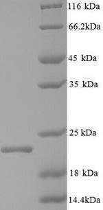 Greater than 90% as determined by SDS-PAGE.Recombinant Hepatitis B Virus Genotype C Subtype Ayw Capsid Protein (C) Protein (His)