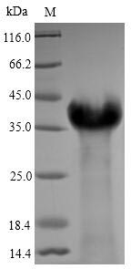 Greater than 90% as determined by SDS-PAGE.Recombinant Epstein-Barr Virus Latent Membrane Protein 1 (LMP1) Protein (His)