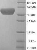 Greater than 90% as determined by SDS-PAGE.Recombinant E.Coli Periplasmic Serine Endoprotease Degp (DEGP) Protein (His)