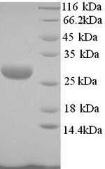 Greater than 90% as determined by SDS-PAGE.Recombinant Mannheimia Haemolytica Leukotoxin (LKTA) Protein (His)