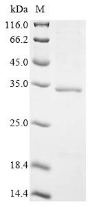 Greater than 90% as determined by SDS-PAGE.Recombinant African Swine Fever Virus Uncharacterized Protein K145R (MAL-059) Protein (His)