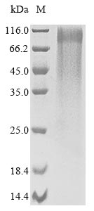 Greater than 85% as determined by SDS-PAGE.