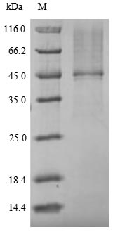 Greater than 85% as determined by SDS-PAGE.Recombinant Cryptococcus Neoformans Var. Neoformans Serotype D Orotate Phosphoribosyltransferase (URA5) Protein (His-SUMOSTAR)