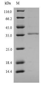 Greater than 90% as determined by SDS-PAGE.Recombinant Mouse Lymphocyte Antigen 6C1 (LY6C1) Protein (His-SUMOSTAR)