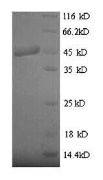 Greater than 90% as determined by SDS-PAGE.Recombinant Clostridium Botulinum Botulinum Neurotoxin Type B (BOTB) Protein (His)