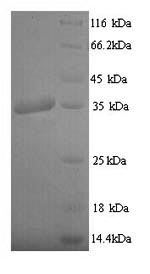 Greater than 90% as determined by SDS-PAGE.Recombinant Epstein-Barr Virus Latent Membrane Protein 1 (LMP1) Protein (His)