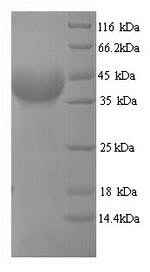 Greater than 90% as determined by SDS-PAGE.Recombinant Plasmodium Falciparum Multidrug Resistance Protein (MDR1) Protein (His)