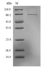 Greater than 90% as determined by SDS-PAGE.Recombinant Lassa Virus Nucleoprotein (N) Protein (His)