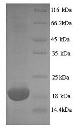 Greater than 90% as determined by SDS-PAGE.Recombinant Mouse Major Urinary Protein 2 (MUP2) Protein (His)