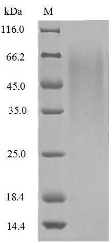 Greater than 85% as determined by SDS-PAGE.Recombinant Influenza B Virus Non-Structural Protein 1 (NS) Protein (His)