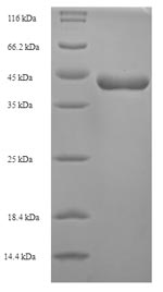 Greater than 90% as determined by SDS-PAGE.Recombinant Schistosoma Mansoni Major Egg Antigen Protein (His)